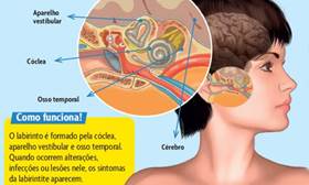 http://mdemulher.abril.com.br/imagem/saude/galeria/labirintite-ilustracao-37776.jpg