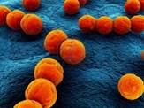 close up of streptococcus bacteria Stock Photo - 6003180