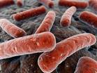 http://stepnrun.com/images/Mycobacterium_tuberculosis_14313982_1.jpg