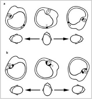 http://www.tinnitusjournal.com/imageBank/images/v16n2a10-fig03.jpg